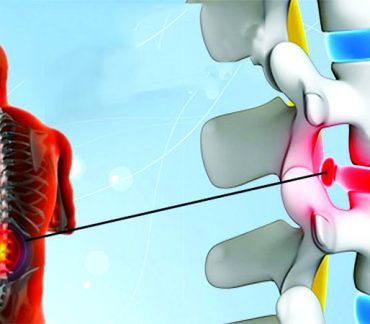 Best Slipped Disc Doctor In Mumbai